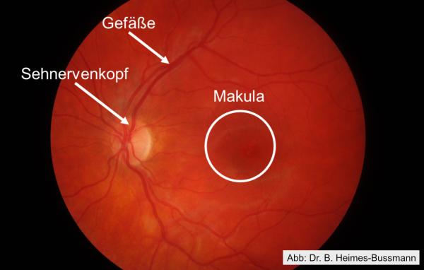 gesunde Netzhaut mit markierter Makula