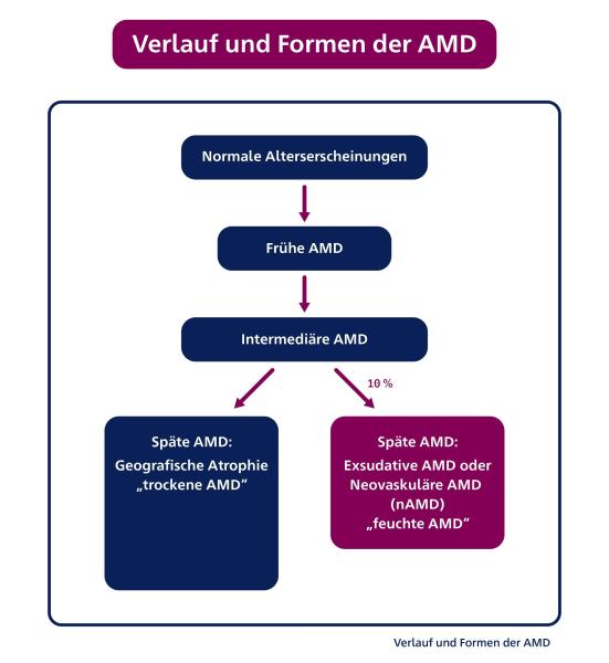 Grafik des Verlaufs und Formen der AMD